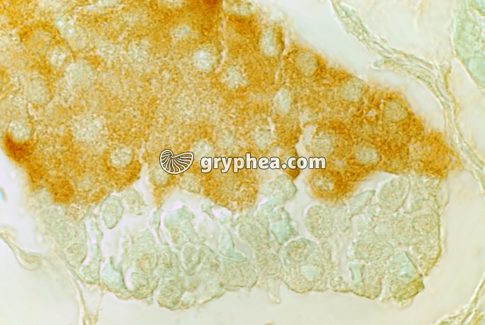 Cellules sécrétrices d'insuline - Ilôt de Langerhans du Pancréas (traitement histochimique) x100 - gryphea.org